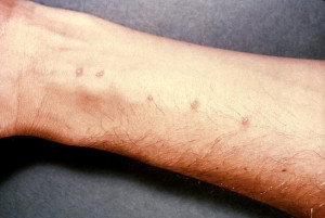 Bőrbetegségek megjelenésének megértése